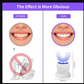 Bright Clean - Whitening Automatic Toothbrush